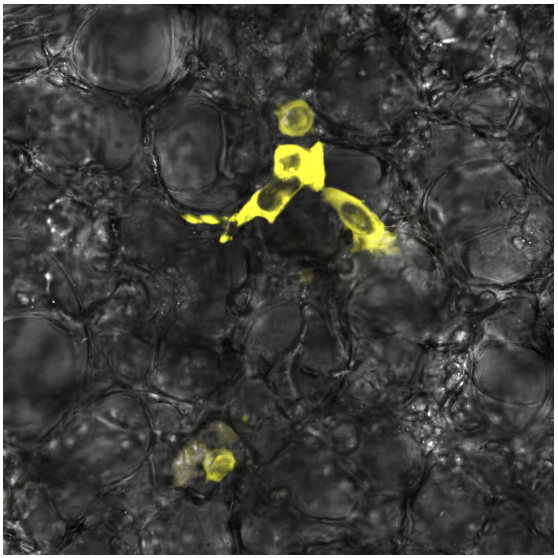 Reporter cells imaged in lung tissue
