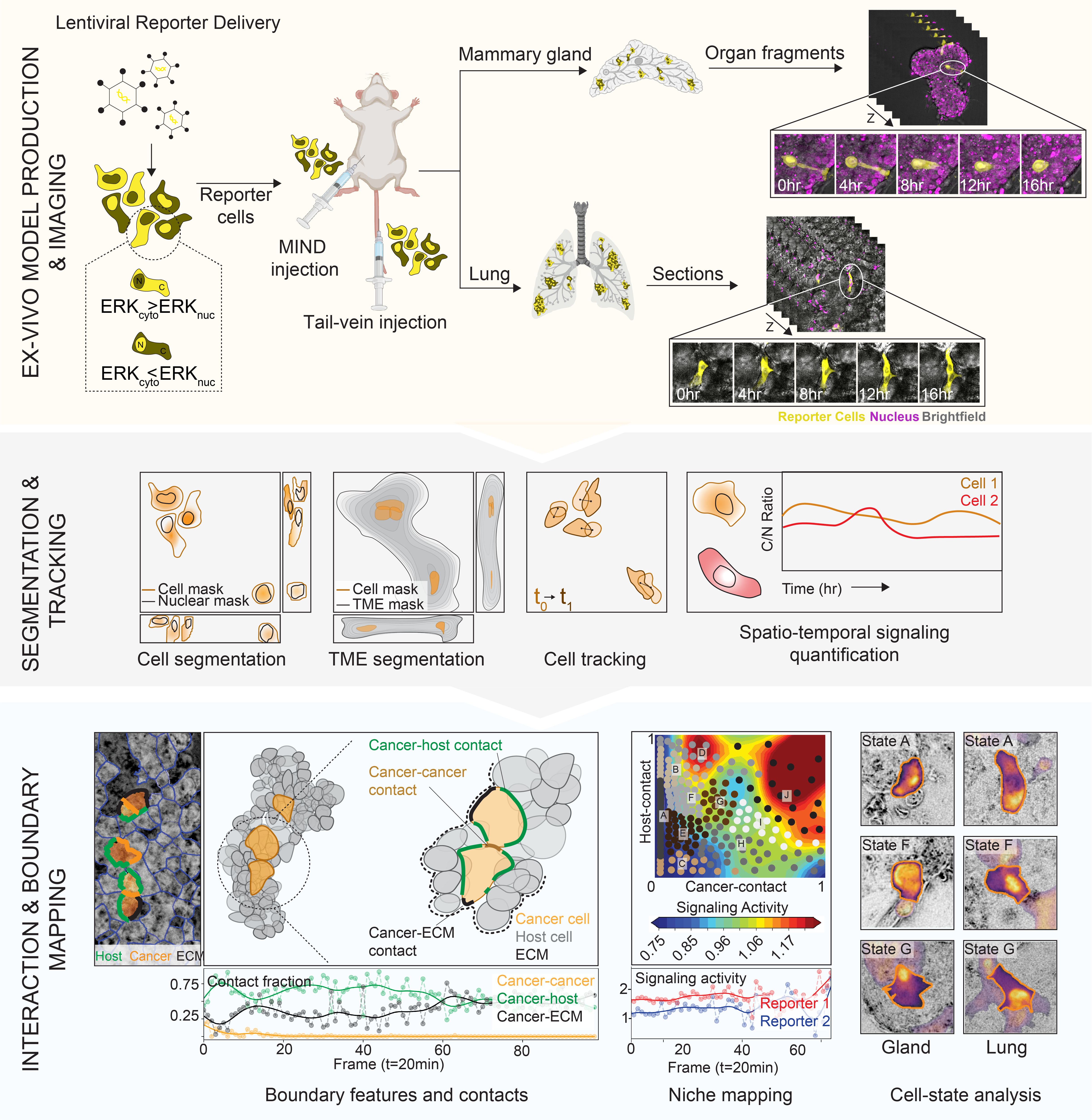 Graphical abstract for Serial Imaging of Tumor and microEnvironment (SITE) platform for live-cell ex vivo modeling of primary and metastatic cancer dynamics